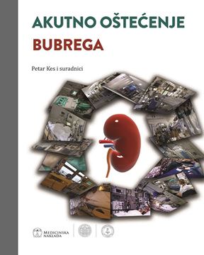 Picture of AKUTNO OŠTEĆENJE BUBREGA